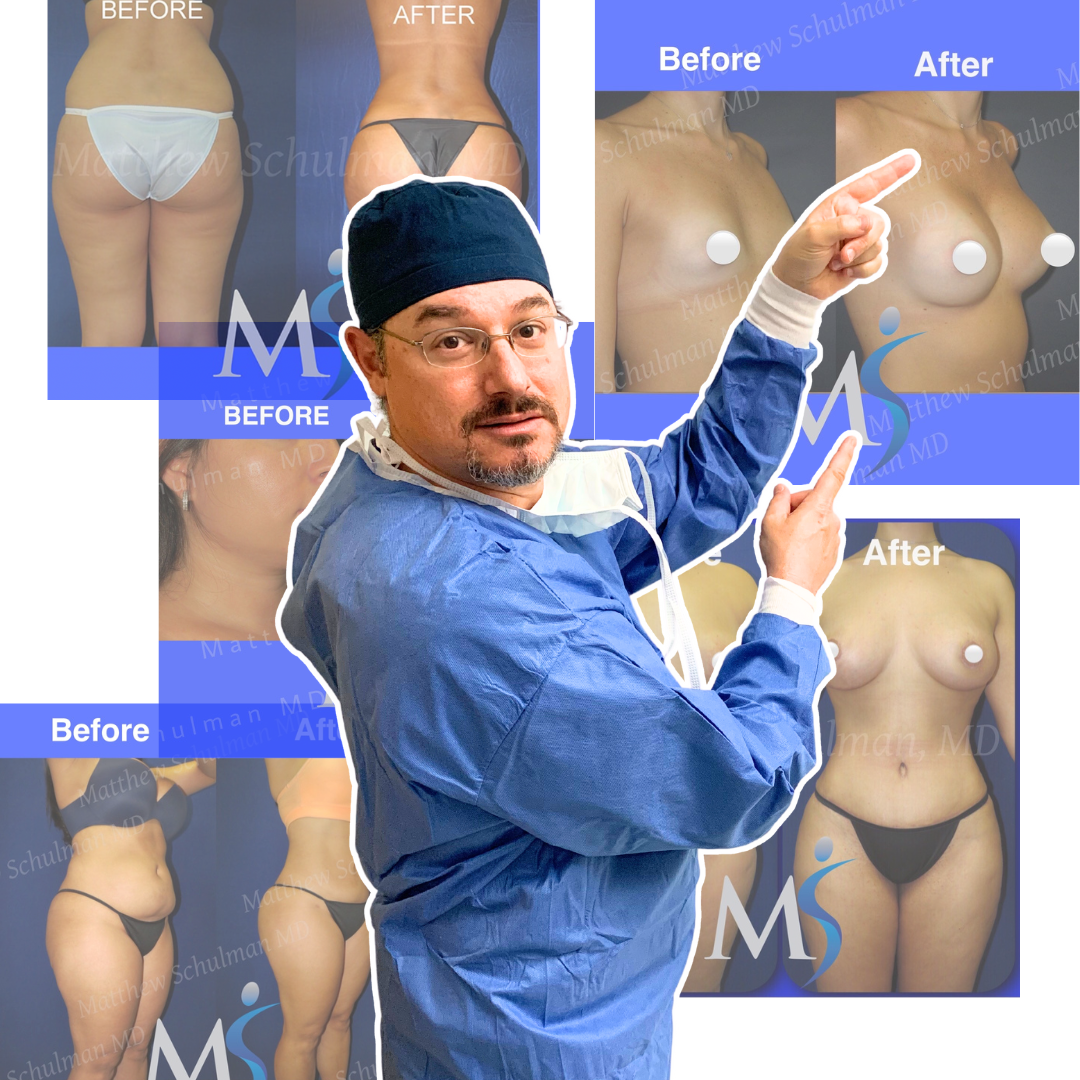 Dr. Schulman in surgical scrubs standing in front of some of his before and after photos
